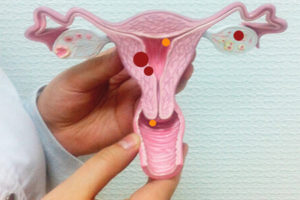 Современная диагностика и лечение дисплазии шейки матки, куда обратиться?