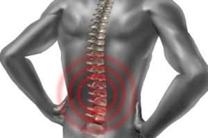 Межпозвоночная грыжа - лечение в клинике 